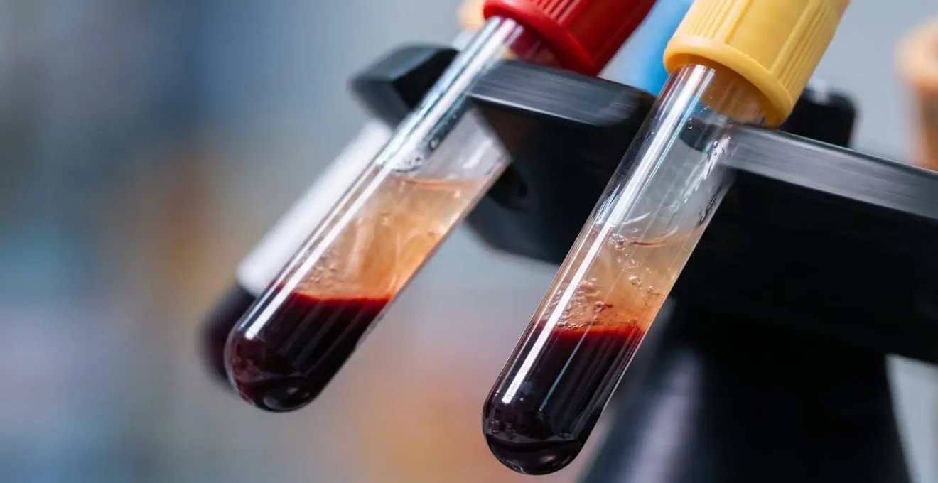 Détail macro d'un échantillon sanguin en cours d'analyse en laboratoire